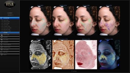 Wrinkles, sun damage & acne scars: This machine revealed all of the flaws on my face Wrinkles, sun damage & acne scars: This machine revealed all of the flaws on my face