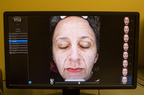 Wrinkles, sun damage & acne scars: This machine revealed all of the flaws on my face Wrinkles, sun damage & acne scars: This machine revealed all of the flaws on my face