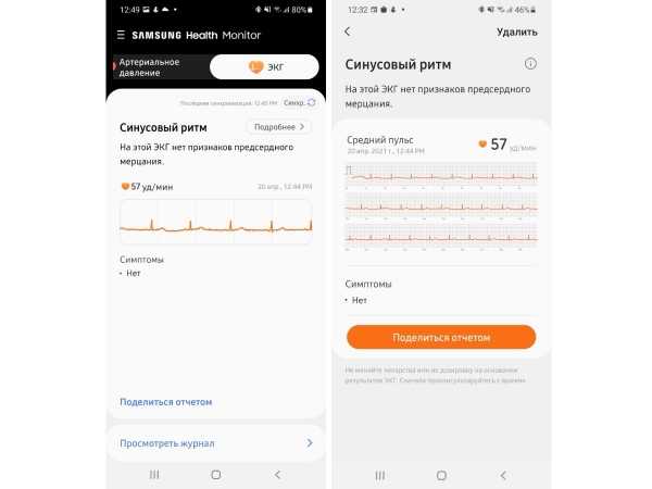 ЭКГ и измерение давления умными часами Samsung: как это работает и можно ли доверять результатам | Журнал Digital World ЭКГ и измерение давления умными часами Samsung: как это работает и можно ли доверять результатам | Журнал Digital World